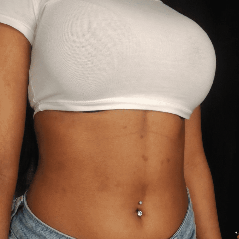 Belly button navel piercing with a curved barbell on a woman's midriff